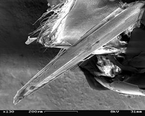 300px-Vespula_vulgaris_SEM_Sting_01.jpg